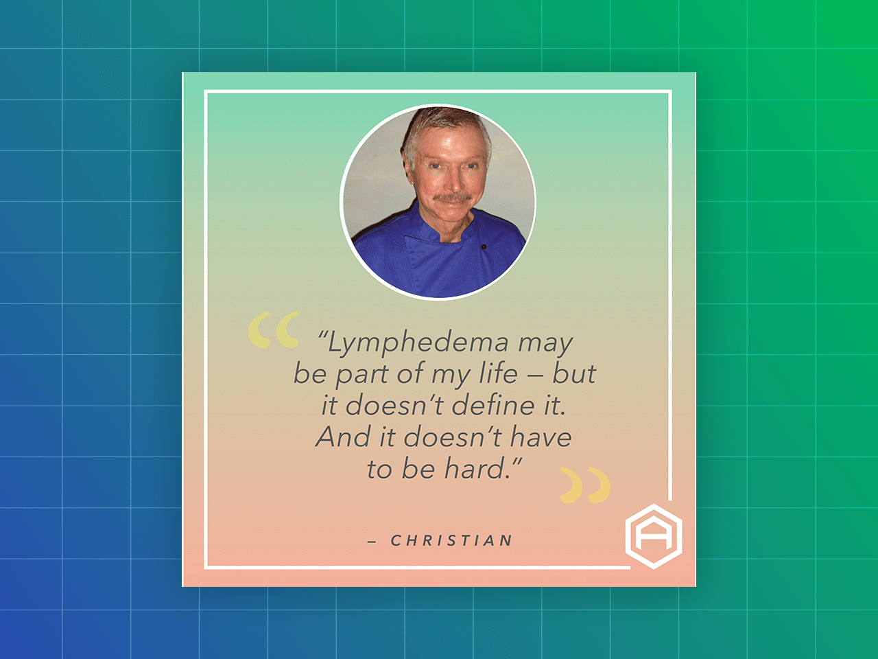 Lymphedema Doesn’t Have to Be Hard: Christian’s Story